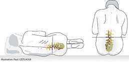 ponction_lombaire_illustration_du_patient.jpg